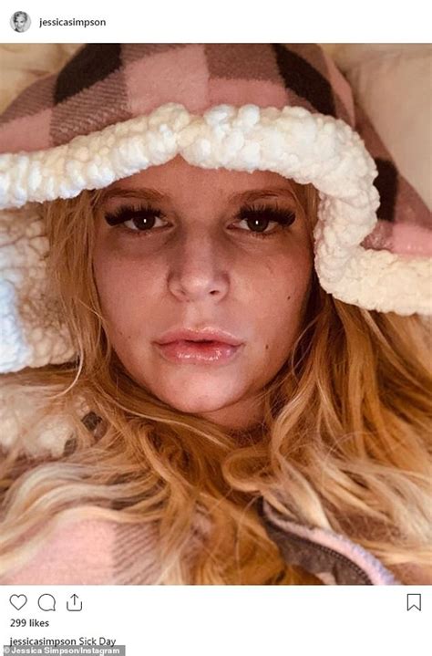 Jessica Simpson Shares Snap Of Her Extremely Swollen Foot Due To Her