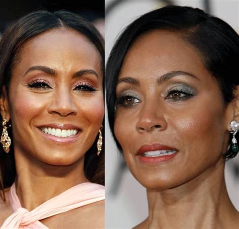 Jada Pinkett Smith Plastic Surgery Before And After Celebrity Plastic