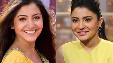 Top Plastic Surgeries Of Bollywood Actresses That Went Wrong Youtube
