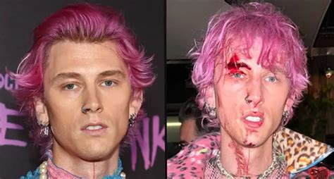 Machine Gun Kelly Left Covered In Blood After Smashing Champagne Glass