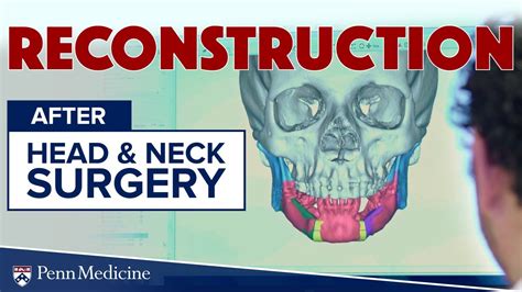 Reconstruction After Head And Neck Surgery Penn Medicine Ent Youtube