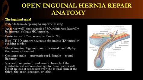 Inguinal Hernia Surgical Anatomy