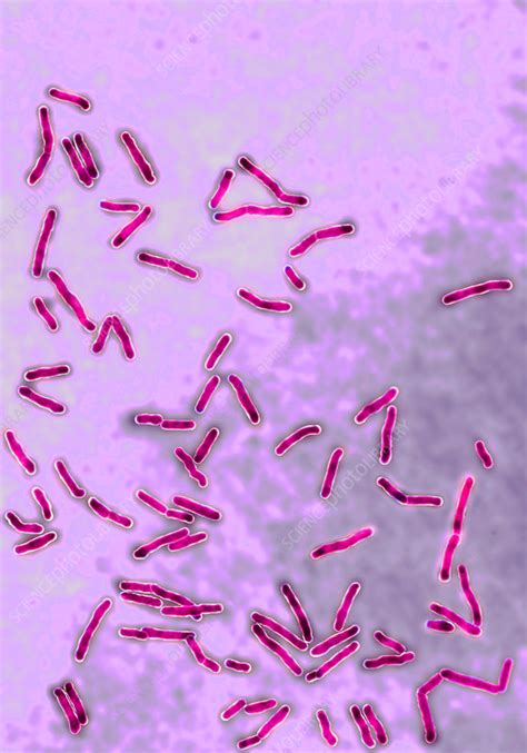 Diphtheria Bacilli Stock Image C0282268 Science Photo Library