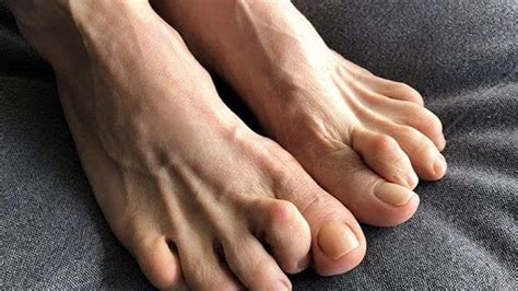 3 Best At Home Exercises For Hammer Toes Kim Holistic Foot And Ankle Center