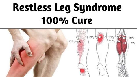 Restless Leg Syndrome In Detail With 100 Treatment Ph 9815187171 Youtube