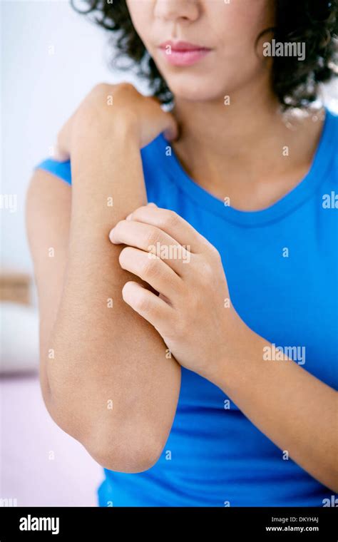 Itching Skin Arm Hi Res Stock Photography And Images Alamy