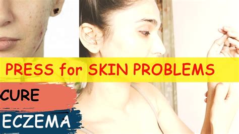 Press To Cure Eczema Natural Treatment For Skin Problems