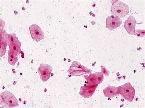 Squamous Epithelial Cells Lm Photograph By Alvin Telser Fine Art America