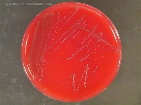 Microcosm Streptococcus Minor More Zoonotic Streptococcal