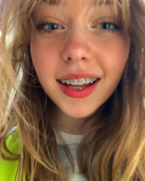 Lily Pearl Crosland 🤍 En Instagram “i Had Such A Long Day Today” Braces Smile Cute Braces
