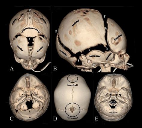 Neural Exam Newborn Head Shape And Sutures Embryology