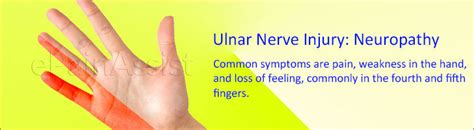 Ulnar Nerve Injury Causes Symptoms Treatment