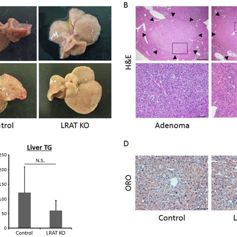 Hepatic Neoplastic Lesions And Steatosis In The Experimental Mice A