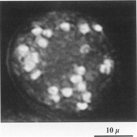 Nuclei In A Chlamydospore Chlamydospores Were Stained With Dapi And