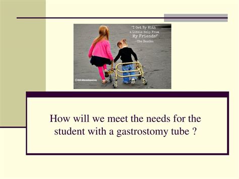 Ppt Gastrostomy Tube Reinsertion Powerpoint Presentation Free