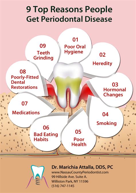 Top 9 Reasons One Gets Periodontal Disease