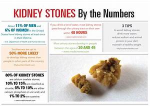 Dealing With Kidney Stones Charleston Physicians