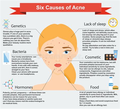 Causes Of Acne Skin Problems And Diseases Beauty Infographics Stock