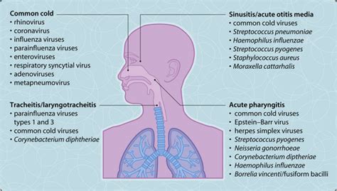 Upper Respiratory Tract Infections Musculoskeletal Key