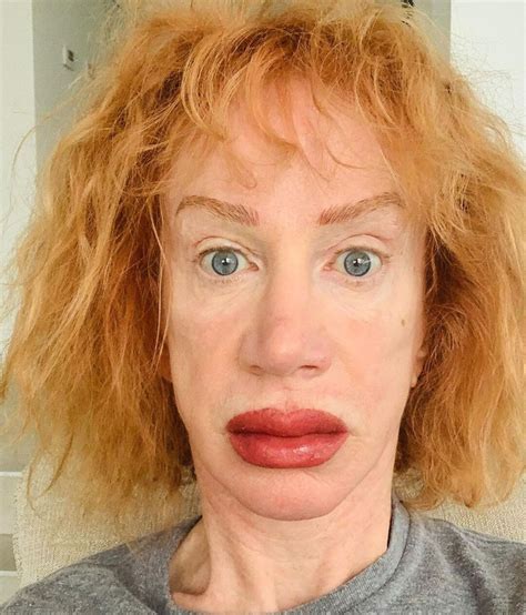 Kathy Griffin Shocks Fans After Showing The Result Of Her Lip Tattoo
