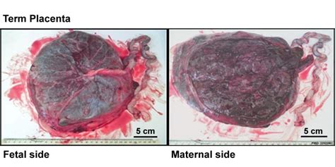 Placenta Development Embryology