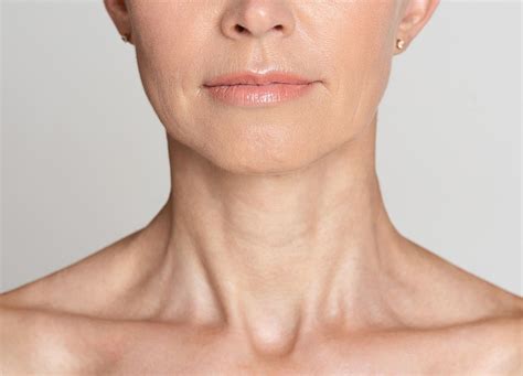 Here S When You Should Try Neck Botox Realself News