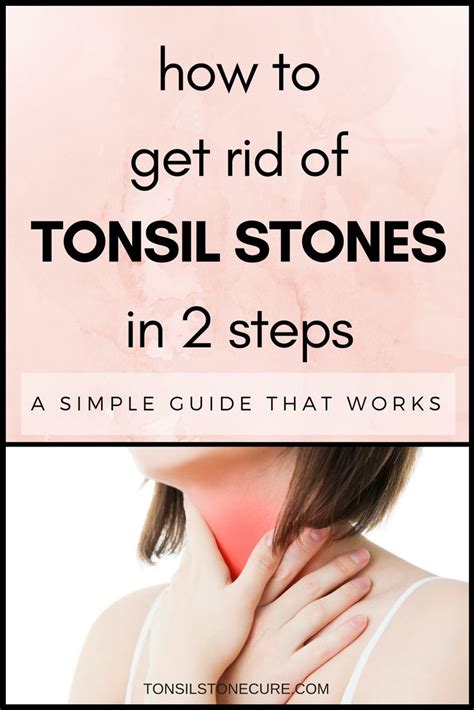 Pin On Tonsil Stone Cures