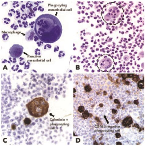 Differentiation Of Mesothelial Cells Into Macrophage Phagocytic Cells