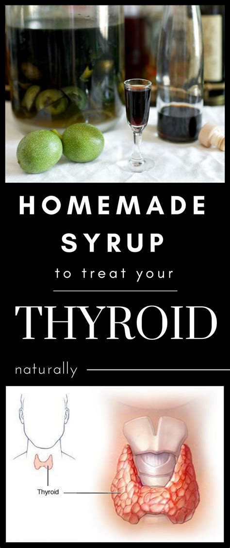 Pin On Treating Thyroid Naturally