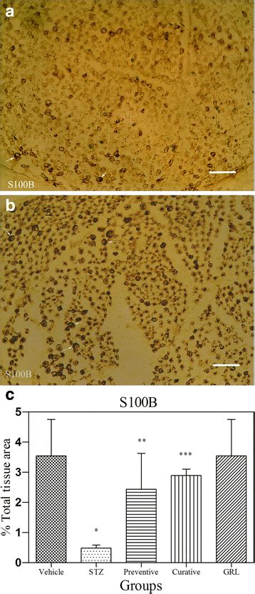 Light Photomicrographs Show Immunohistochemical Expression Of S100B In