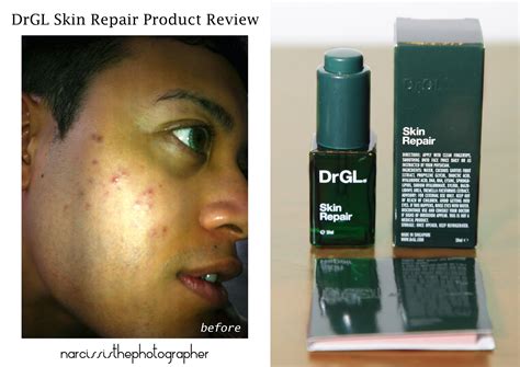 New york skin solutions — incomplete service and cheating on customer. narcissistheblogger: New York Skin Solution Visit DISASTER!