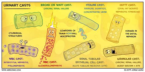 Waxy Cast Urine