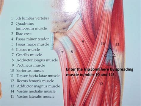 Anterior Hip Replacement Precautions