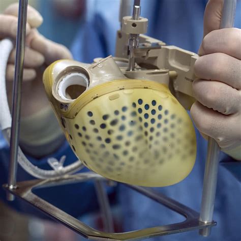 What Is A Total Artificial Heart Tah Uofl Health