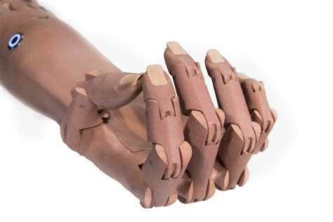 Not All 3d Printed Prosthetics Are Created Equal Unlimited Tomorrow
