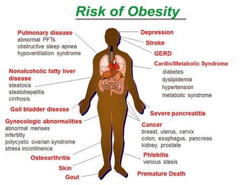 Obesity And Growing Health Risks Everyone Should Know Doctor Asky