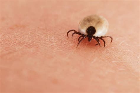 How Long Should It Take For A Tick Bite To Heal Things You Didnt Know