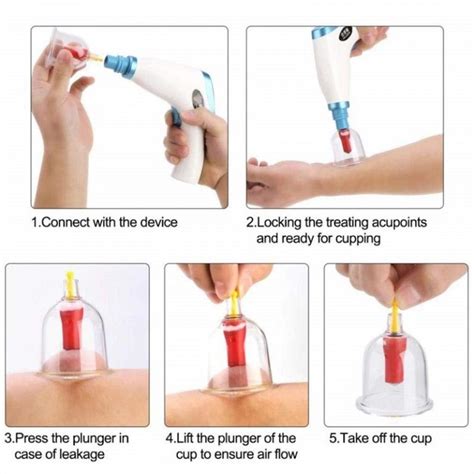 Electric Massage Recovery Cupping Gun World T Deals