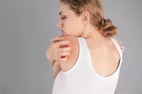 Heat Rash Symptoms Causes Treatments And Precaution