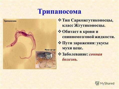 Диета при заболевание желчный пузырь