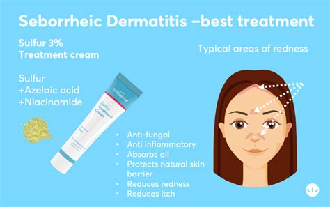 Seborrheic Dermatitis Face Women