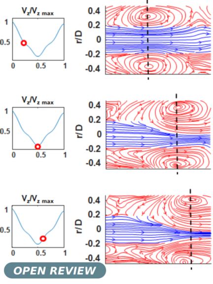 Vortex Dynamics Under Pulsatile Flow In Axisymmetric Constricted Tubes