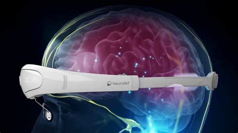 FDA Clears Neuromodulation Device For Acute Migraine Pain