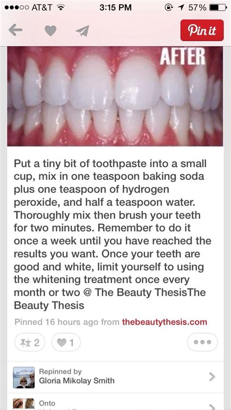 How To Get White Teeth Fast Easy Strong Mouth Pinterest