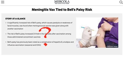 Bell's palsy usually goes away by itself without treatment. Do Vaccines Cause Bell's Palsy? - VAXOPEDIA