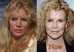 Kim Basinger Plastic Surgery Before After Facelift, Botox Photos