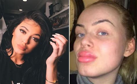 kylie jenner challenge teens are using bottle tops to get kylie jenner lips and it s terrifying
