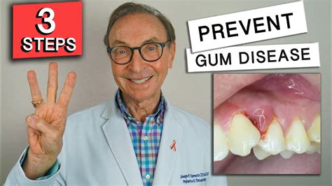 Easy Ways To Prevent Gum Disease At Home Youtube