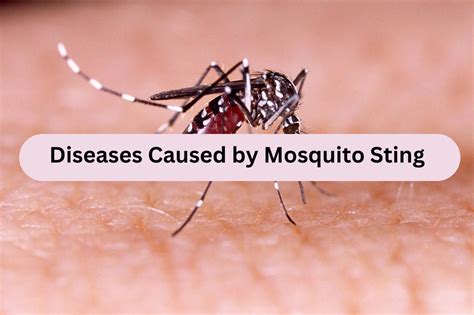 Diseases Caused By Mosquito Sting