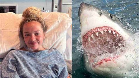 Teenage Girl Survives Shark Attack At Florida Beach